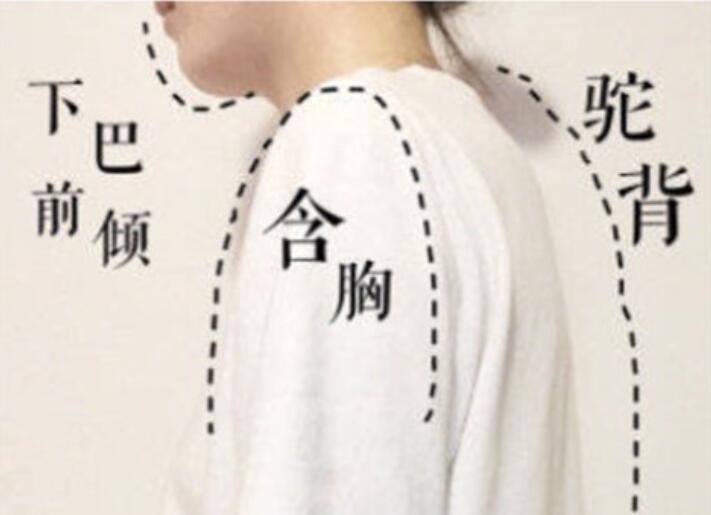 南寧美容學(xué)校：堅(jiān)持一個(gè)月，駝背變直背