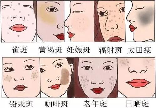 南寧美容學校：這7個日常習慣給你一臉斑