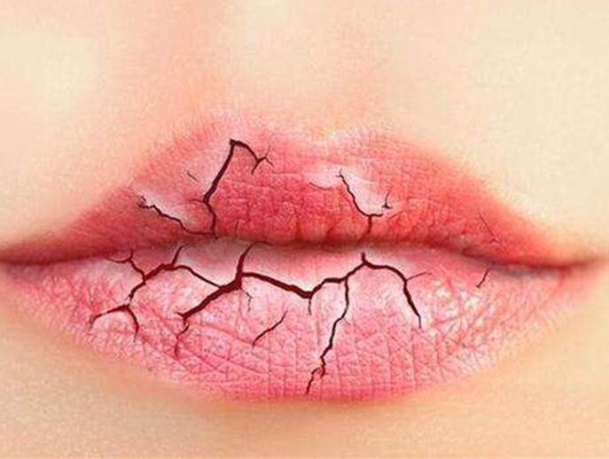 6個(gè)美容技巧，解決秋季嘴唇干燥