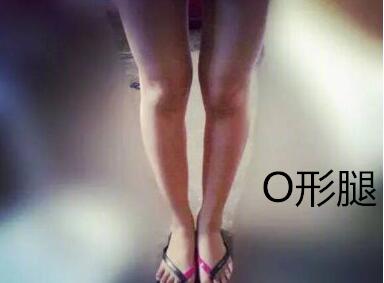 糾正你的腿型！