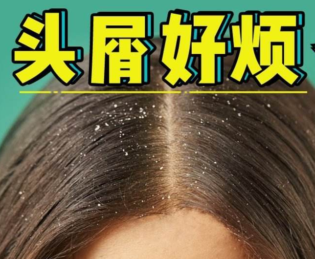 南寧正規(guī)美發(fā)培訓(xùn)學(xué)校分享：冬天如何減少頭屑過多？