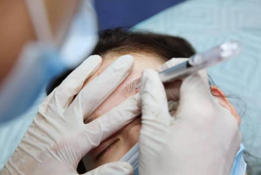 紋繡遇到容易出血的皮膚怎么辦？南寧專業(yè)紋繡培訓(xùn)教你