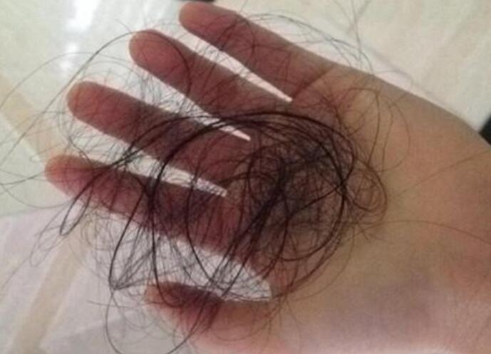 脫發(fā)女孩必備寶典！南寧美發(fā)學(xué)校教你