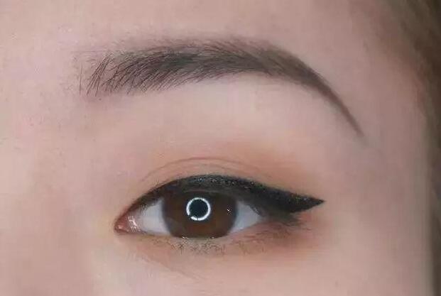 眼尾三角區(qū)怎么處理？