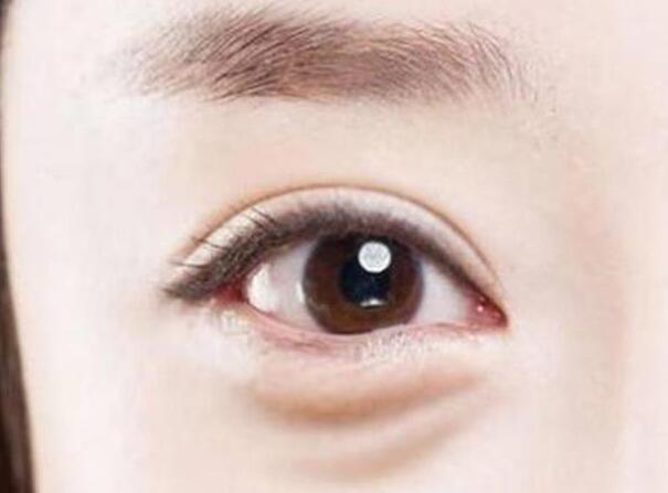 眼袋？淚溝？臥蠶？南寧美容學校教你辨別