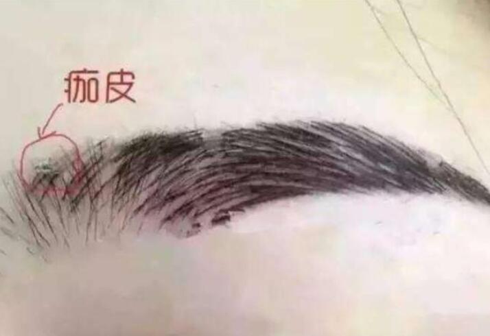 紋眉結痂時要注意什么？麗紋竹繡學校教你