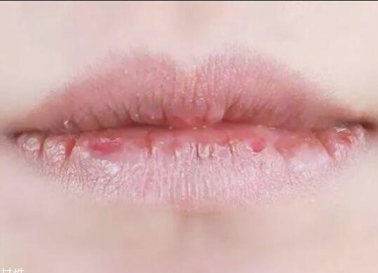 紋唇后嘴巴干燥怎么辦？南寧教紋繡的學(xué)校幫你解決