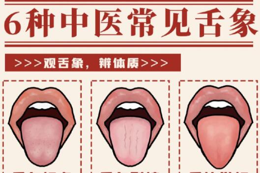 6種常見中醫(yī)舌診判定，快和廣西中醫(yī)美容一起學(xué)