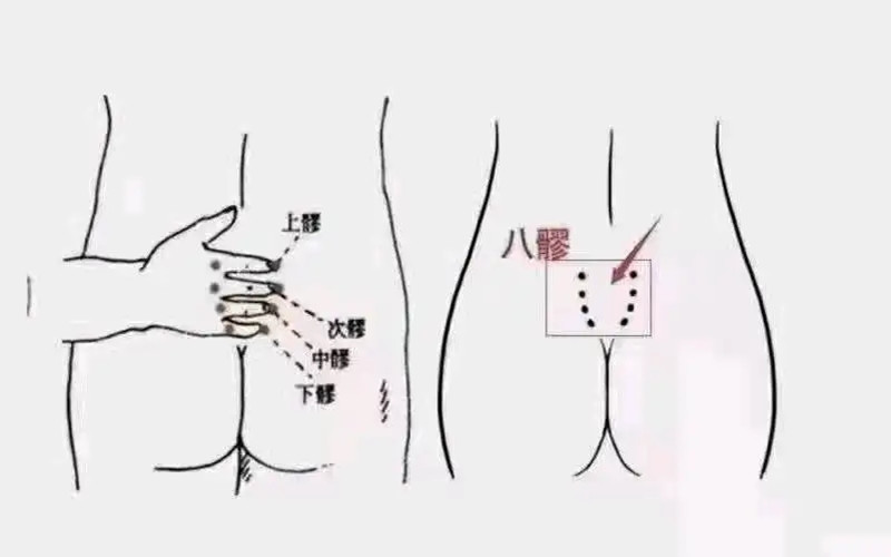 疏通八髎注意事項(xiàng)，南寧中醫(yī)美容學(xué)校培訓(xùn)內(nèi)容