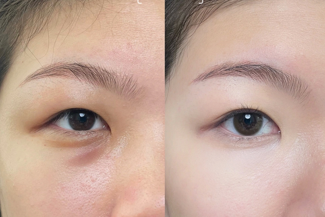 新手遮瑕教程，南寧化妝課程基礎分享