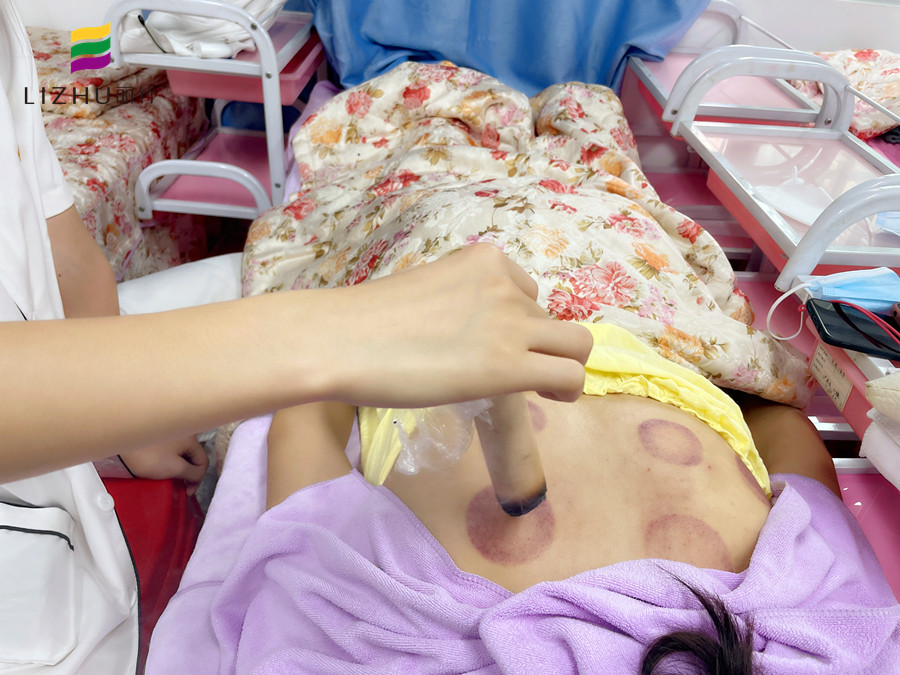 艾條艾灸注意事項(xiàng) ，廣西美容職業(yè)學(xué)校實(shí)操演示