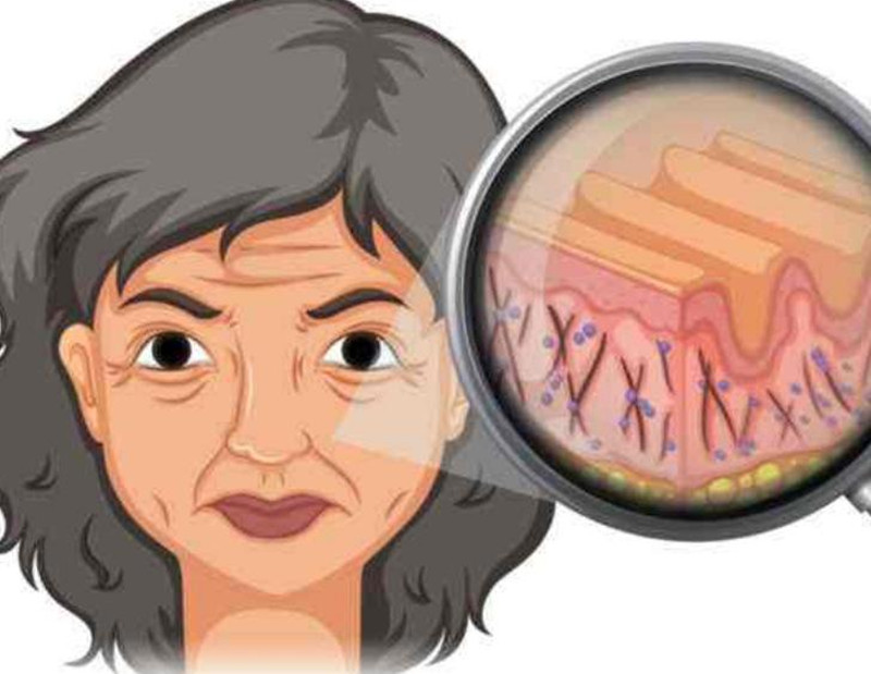 女性如何延緩衰老？南寧皮膚管理培訓班講解