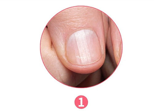 女生氣血不足六大表現(xiàn)，南寧美容養(yǎng)生資訊報(bào)道