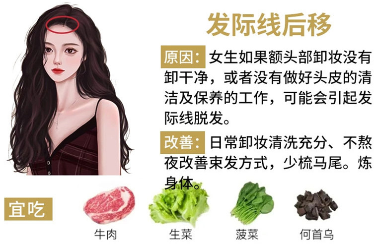 如何改善掉頭發(fā)？南寧頭療養(yǎng)發(fā)護(hù)發(fā)教學(xué)