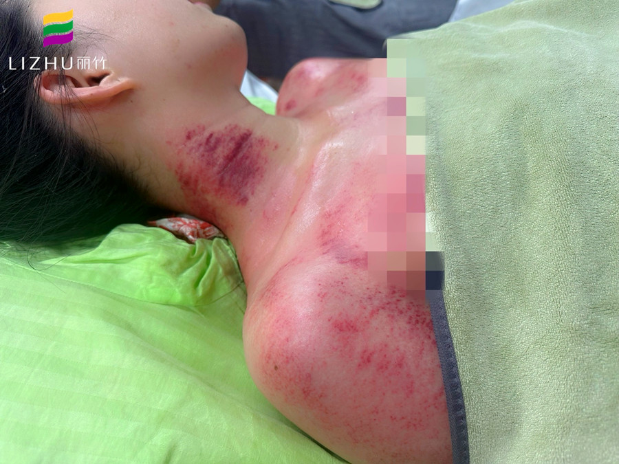 廣西學(xué)刮痧培訓(xùn)班 | 廣西學(xué)刮痧學(xué)費多少？