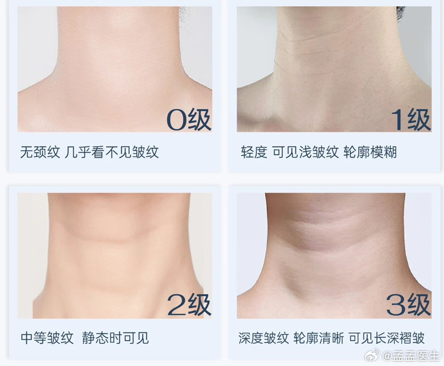 如何緩解頸紋？南寧美體美容管理培訓(xùn)