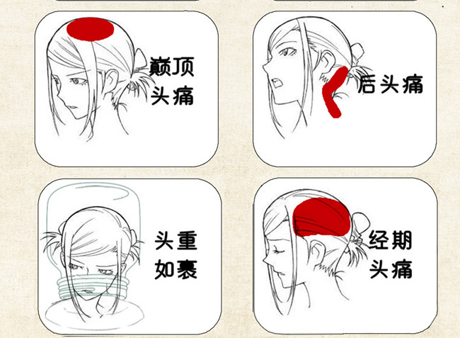 不同頭痛類型經(jīng)絡護理方法，廣西中醫(yī)美容培訓
