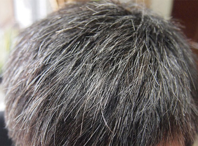 南寧美發(fā)基礎(chǔ)教學(xué)：為什么會長白頭發(fā)？